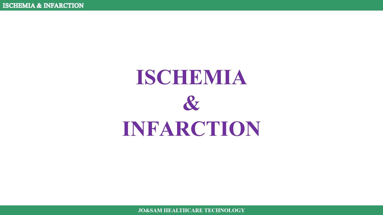 Ischemia And Infarction Within 60 Seconds Tamil YouTube ischemia-and-infarction-within-60-seconds-tamil-youtube