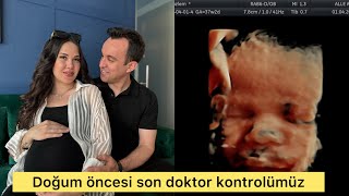 39. HAFTA DOKTOR KONTROLÜ