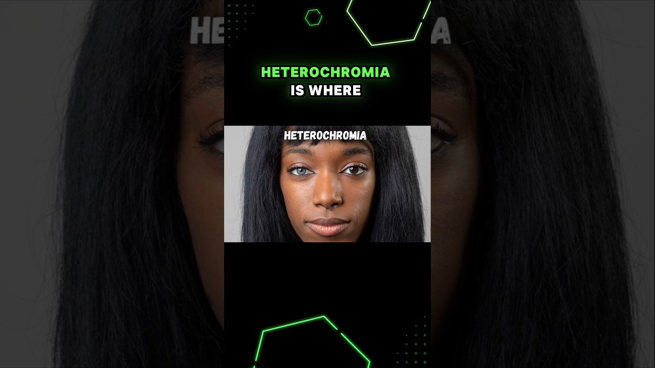 Multiple Colors in One Eye or Two Differently-Colored Eyes!