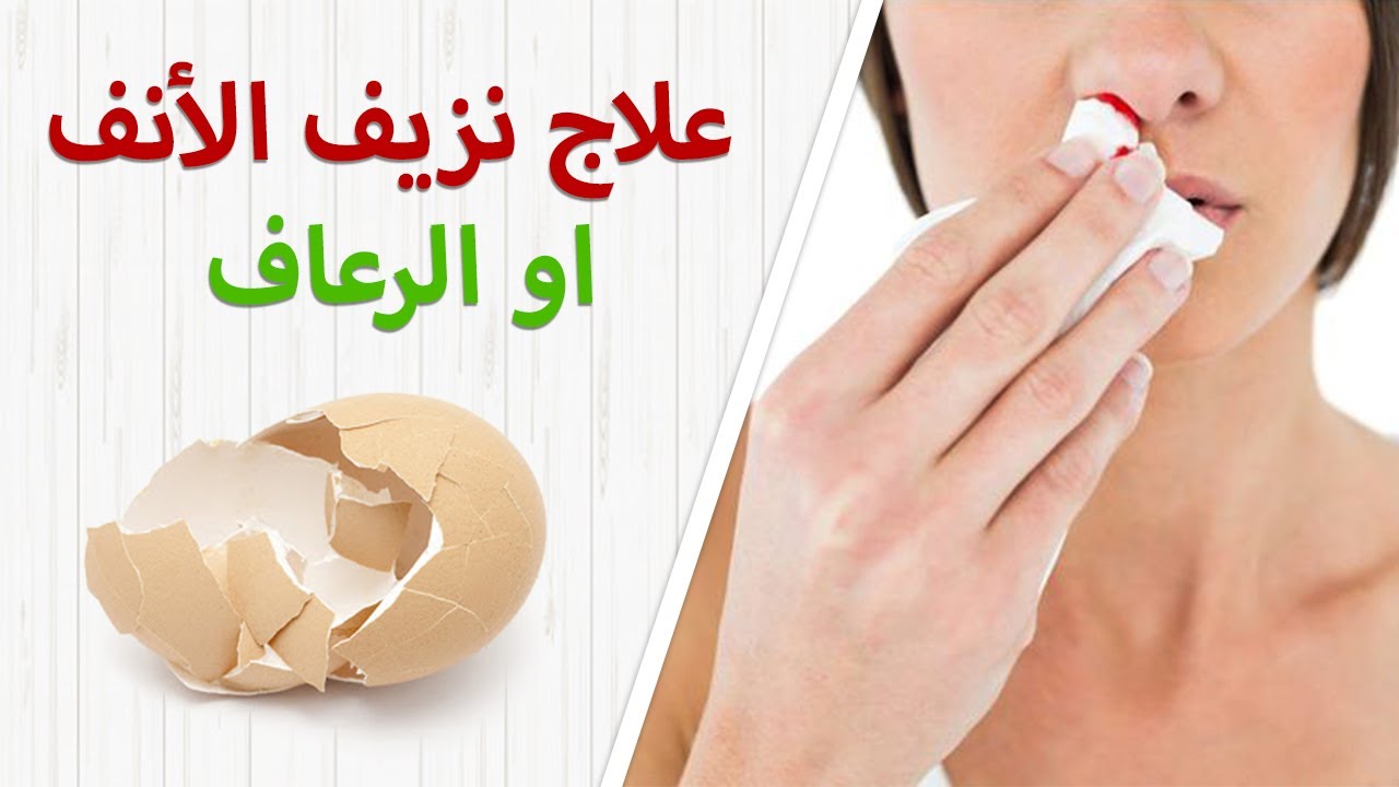 علاج نزيف الأنف او الرعاف بطريقة مجربة وفعالة - YouTube