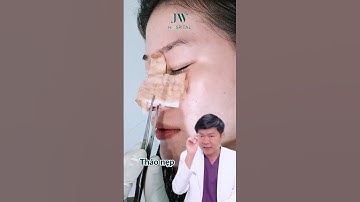 SỐC: Gen Z chơi lớn BÁN HƠN 5 CHỈ VÀNG can đảm đến JW CẮT MẮT, NÂNG MŨI S LINE 7 ngày hóa Hotgirl