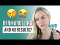 Not Seeing Results After Dermarolling? You Should WATCH THIS.