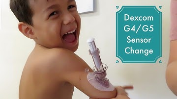 DEXCOM G4 / G5 SENSOR CHANGE