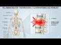 lower back pain exercise.