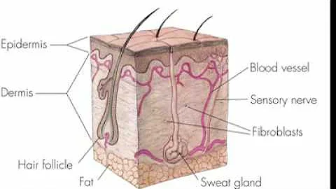 How long after laser resurfacing do you see results?