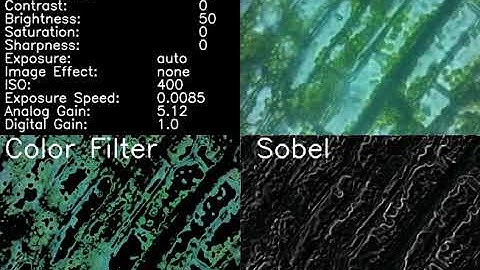 Computer Vision Microscope Imaging