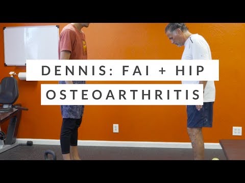 Hip pain from femoroacetabular impingement and hip osteoarthritis - one week progress report