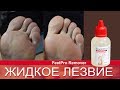 Как правильно использовать жидкое лезвие для педикюра FeetPro? Кислотный педикюр.