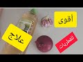 وصفة طبيعية للقضاء على الفطريات مجربة وناجحة 