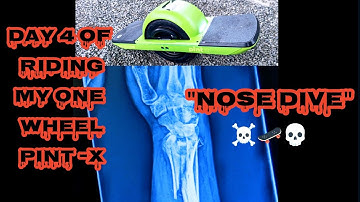 OneWheel Pint X 4 days 12 miles, nose dive, broken wrist