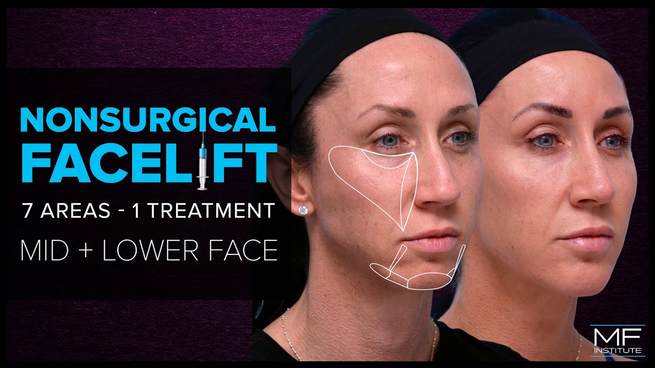 What's a Non Surgical Facelift at Mabrie Facial Institute?