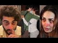 Arjun Kapoor Exposed Malaika Arora for Cheating on Him