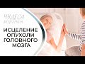 ИСЦЕЛЕНИЕ ОПУХОЛИ ГОЛОВНОГО МОЗГА. «Чудеса исцеления»