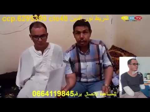 حكاية نور الدين شريط شاب بترت يداه في حادث عمل من دائرة زريبة الوادي ولاية بسكرة