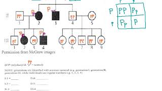 70 - Pedigree Chart - Polydactyly (p51)