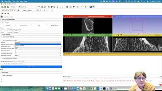 Slicer Bone Imaging Toolbox: Bone Contouring and Mask Generation Update