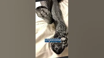Муж принял ногу жены за змею и сломал ее стальным прутом