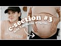 WHY I'M CHOOSING A SCHEDULED C-SECTION...
