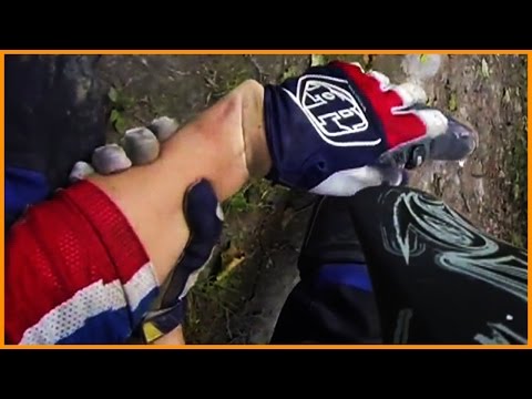 BRUTAL Dirtbike Crashes - Broken Bones & Fails [Ep.#33]