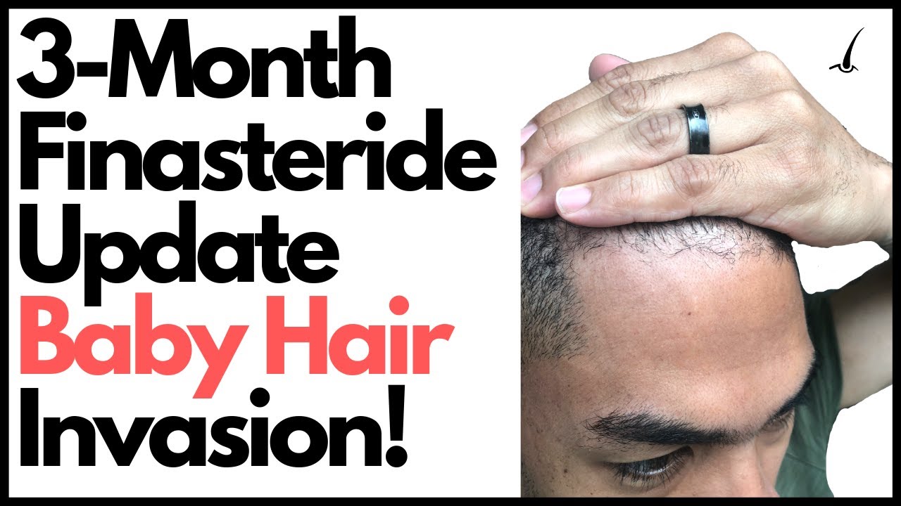 Cheapest Place To Buy Propecia Online