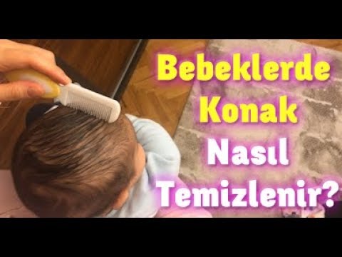 Video: Bir çocuğun Kafasındaki Kabuklar Nasıl Kaldırılır