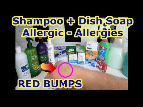 Allergy + Allergic To Shampoo + Dish Soap + Hand + Shower Bath Body Gel + Conditioner = 3 Ingredient