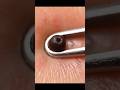 【ASMR】10年ものの超巨大角栓を引っこ抜け!#shorts #角栓
