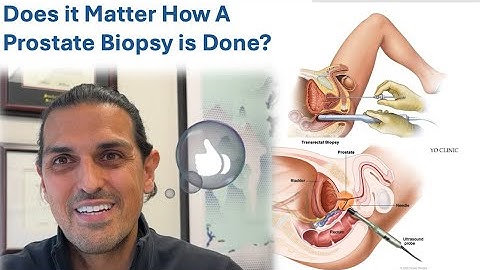 Does it Matter How You Do a Prostate Biopsy? Transperienal vs Transrectal Prostate Biopsy