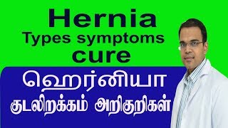 Hernia Types Symptoms Cure ஹென்ரியா குடலிறக்கம் அறிகுறிகள் Best Laparoscopy Hernia surgery hospital
