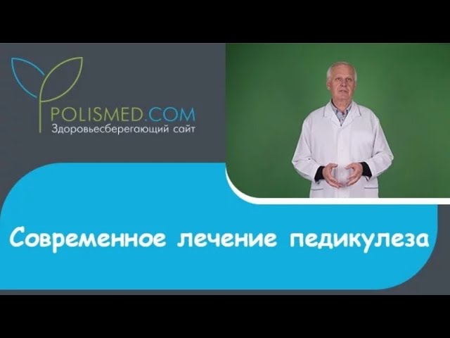 Современное лечение педикулеза: Паранит, Веда, Лавинал, Хигия, Педикулен, Пара Плюс, Нюда, Никс