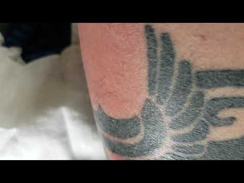 How to treat an infected tattoo What are some tips  Quora