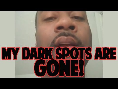 Dark Spot And Hyperpigmentation Treatment - YouTube