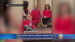 ‘Not A Dry Eye In The Room!’: Boy With Spina Bifida Walks For First Time At Preschool Graduation