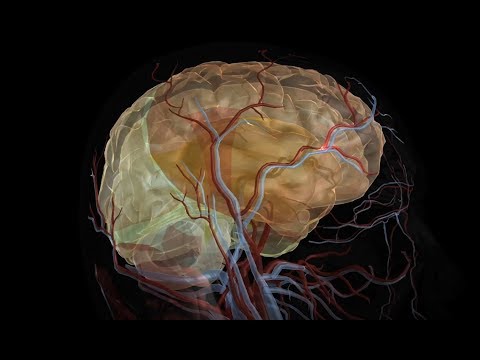 Video: Stroke Vs. Aneurysm: Gejala, Penyebab, Outlook, Dan Lainnya