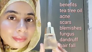 Tea tree oil benefits | zartasha zar | tea tree oil for acne scars |