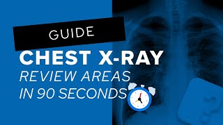 Exclusive Chest X-Ray Review Areas in 90 seconds Information