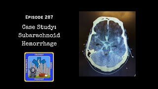 Episode 287 - Case Study: Subarachnoid Hemorrhage