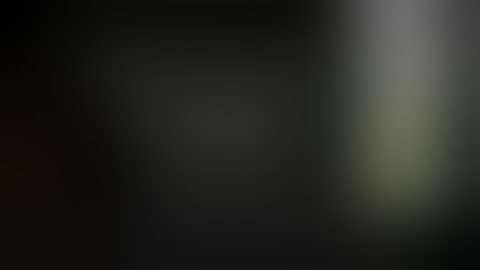 Extraarticular Calcaneal Fracture (Beak Type)