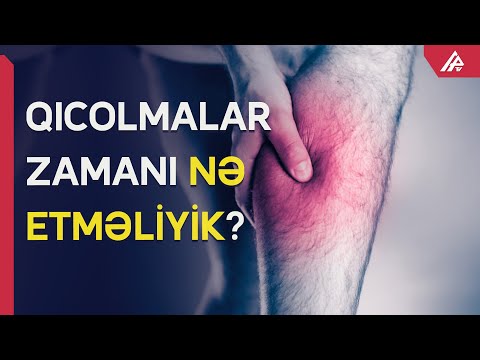 Video: Niyə sternokleidomastoid əzələm ağrıyır?