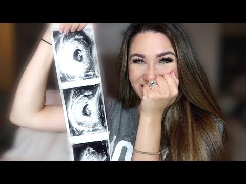 6-weeks-pregnant!-|-baby-#2-update-&-first-ultrasound-|-liza-adele