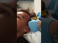 PRP for Hair Loss | Natural Regrowth Treatment at Skinfinity Leeds