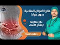 ٤٥- علاج الامراض المناعية بدون دواء _ ارتشاح الامعاء العلاج وزيادة المناعة