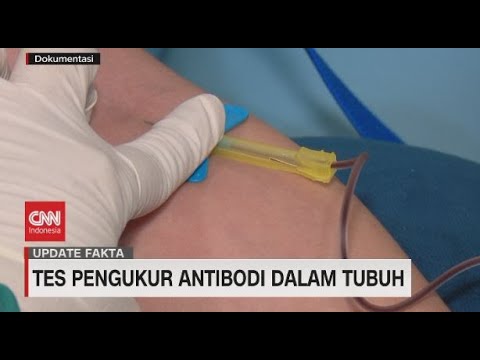 Video: Ujian Titer Antibodi: Tujuan, Prosedur, Dan Penyediaan