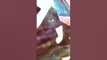 Thumbnail of Police Truck (cover) @DeadKennedysVEVO @DeadKennedysOfficial @thepeckhampoet1909