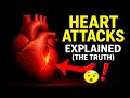 The REAL Cause of Heart Attacks (It’s NOT Cholesterol…) | The Hidden Triggers Doctors Ignore.