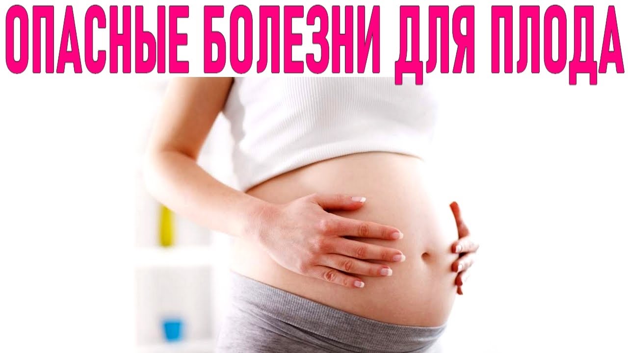 Беременность начало отзывы. Беременность не болезнь. Беременность, роды, материнство. Просто беременных.