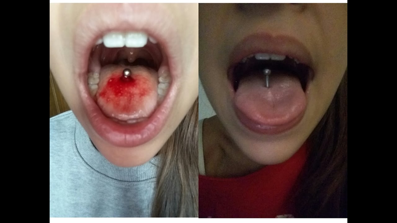 Mi experiencia con el piercing de la lengua