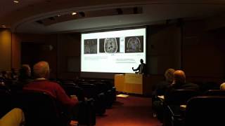 Mark M. Souweidane, MD - Direct Drug Delivery as a Therapeutic Platform in NeuroOncology