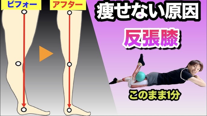 足が痩せない原因 反張膝の治し方 細くならないあなたの足 反張膝 じゃないですか 太もも ふくらはぎを細くする方法 Youtube
