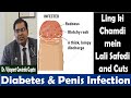 Diabetes aur ling me infection | Diabetes Skin Problem (Hindi)